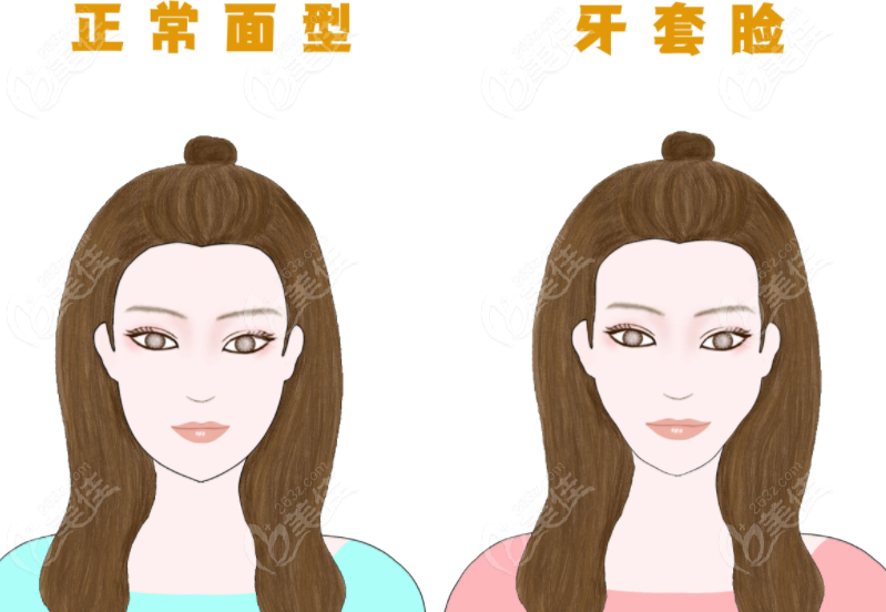 吃口香糖能改善牙套脸吗
