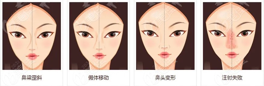 大连隆鼻修复手术类型