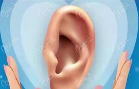 人工生物耳支架耳再造