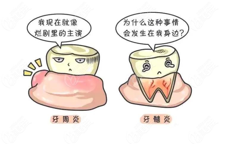 牙髓炎和牙周炎的区别