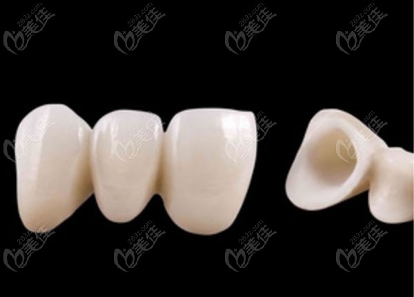 门牙缺失的修复方法全瓷牙冠