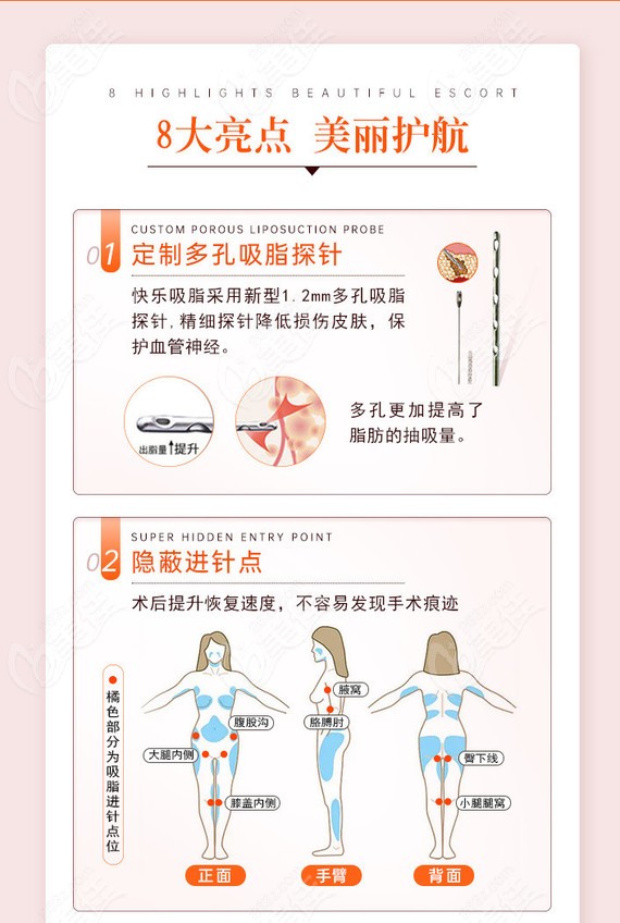 南京美贝尔快乐吸脂技术可靠的八大优势