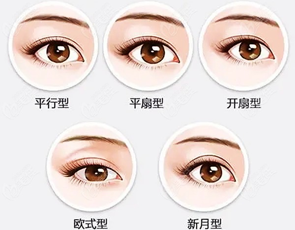 在錦然整形這幾種類型的雙眼皮都可以做 在錦然整形這幾種類型的雙眼皮都可以做