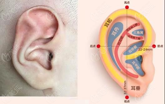耳朵分类类型