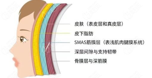 双平面面部提升作用层次示意图