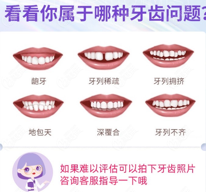 这些症状都可在杭州临平康洁口腔做牙齿矫正