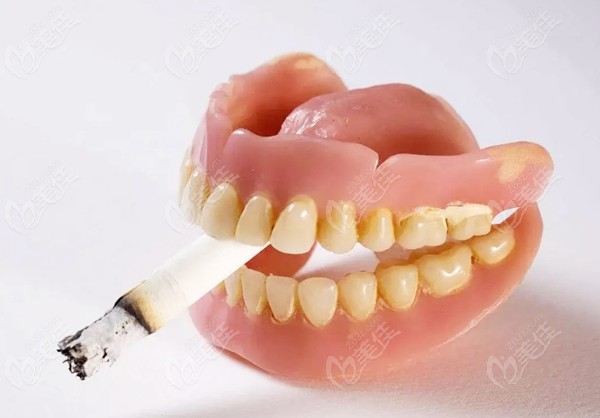 抽烟的人能做种植牙吗