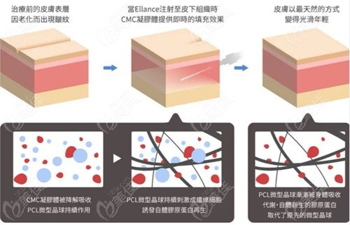 伊妍仕少女针成分结构图