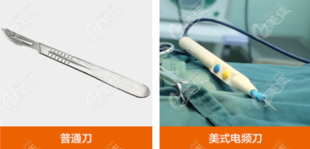 美仑美奂用的是美国force fxtm-8c高频电刀切割双眼皮,这种电刀会以