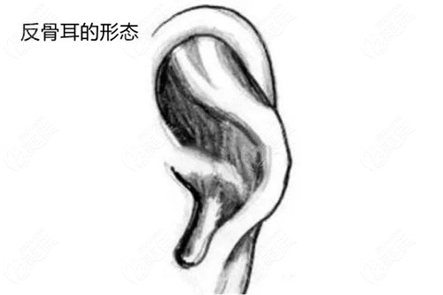 耳朵反骨真正位置图片图片
