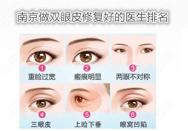 南京做双眼皮修复好的医生排名