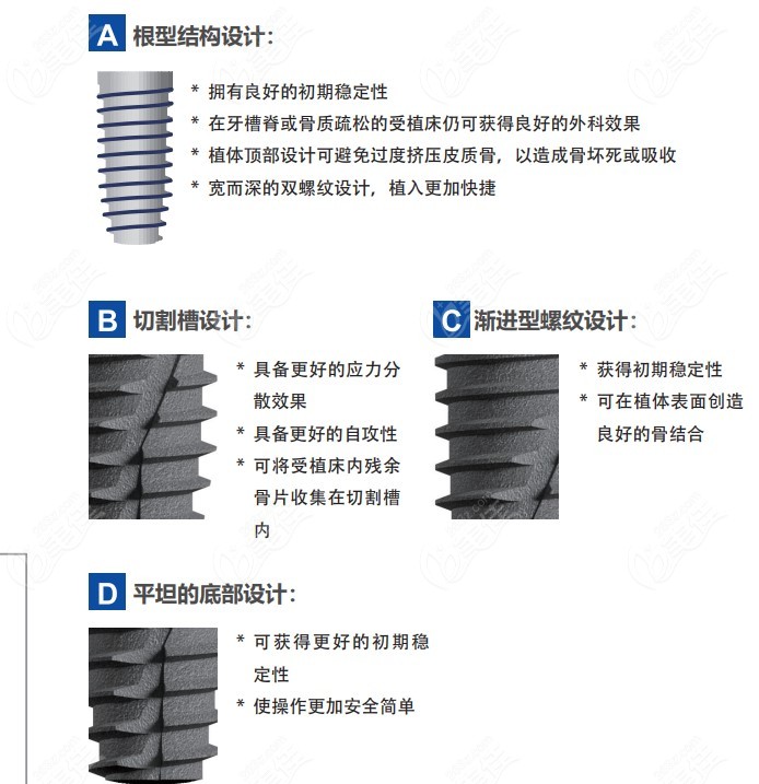 仕诺康种植体设计优势