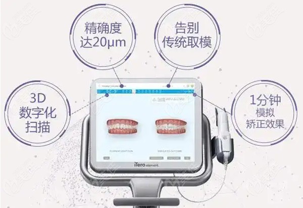 ITERO口腔扫描仪技术优势