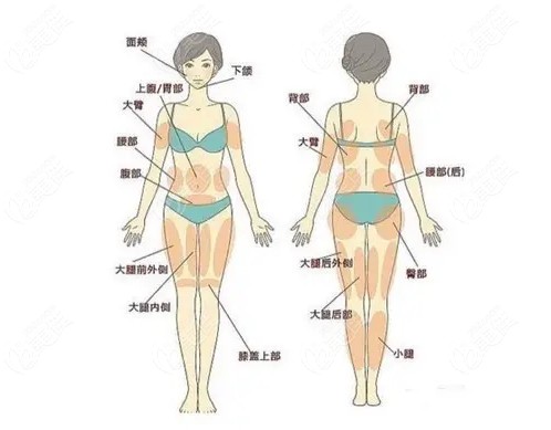 贵阳抽脂手术大概花多少钱