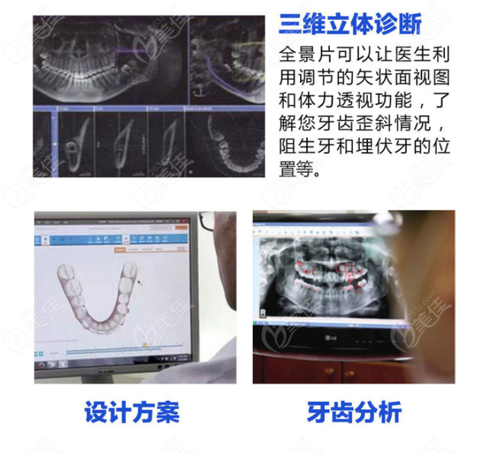 合肥贝杰口腔牙齿矫正怎么样