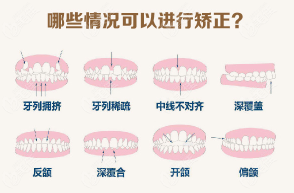 合肥贝杰口腔牙齿矫正好吗