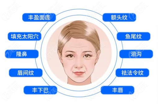 <!--<i data=20240703-sp></i>-->注射玻尿酸的部位图