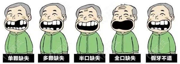 保定哪个医院种植牙技术好