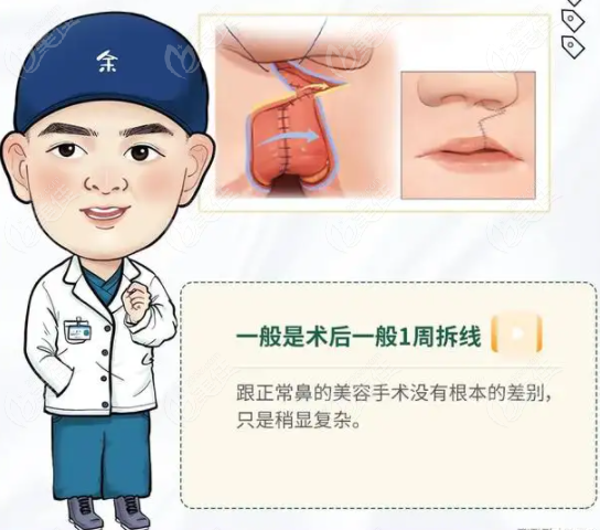 广州高尚唇裂二期修复