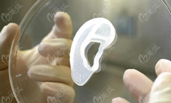 3D打印的耳植入物AuriNovo