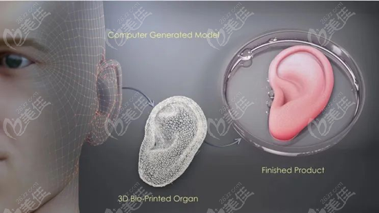 3d打印耳朵再造术3D建模