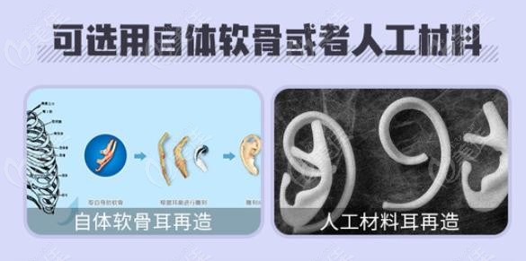 常用的耳再造材料是肋骨和人工骨材料