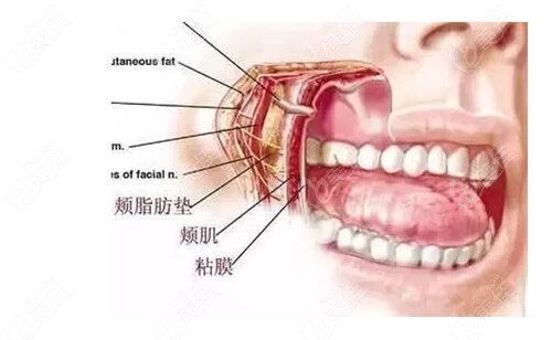 www.236z.com提供的下颌角颊脂垫图片