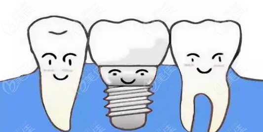 种牙和镶牙有什么区别