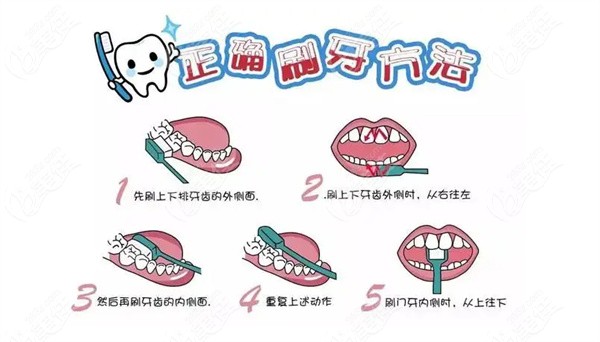 正确的刷牙方法——巴氏刷牙法学起来