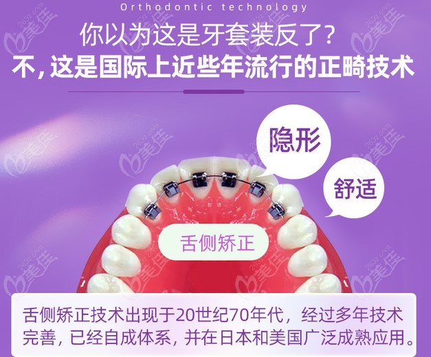 智控隱形舌側(cè)矯正