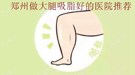 郑州大腿抽脂好的医院