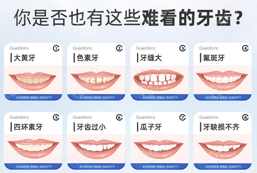 太原众牙口腔常做的瓷贴面的类型