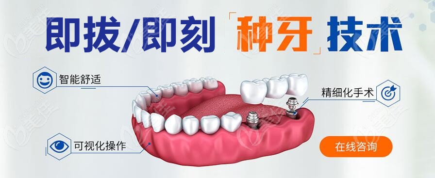 登特斯种植体型号图谱图片