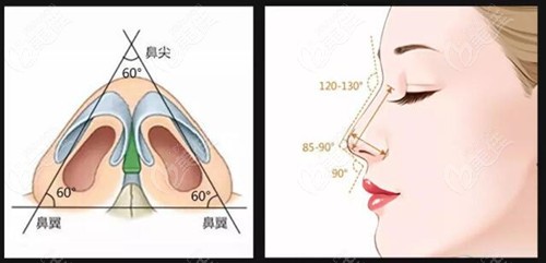 www.236z.com提供的超肋鼻隆鼻成效图