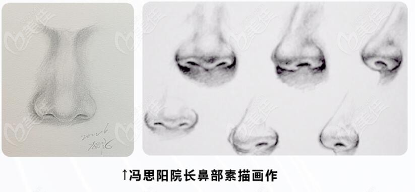 <i data-id='628ed5cf-16c5-4ec5-91f7-dcb2cbda0c74' style='display:none;'></i><!--<i data=20240703-sp></i>-->鼻子实例风格偏自然