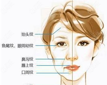 面部衰老示意图