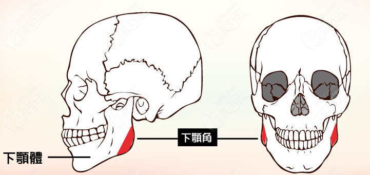 吴中兴医生下颌角手术部位