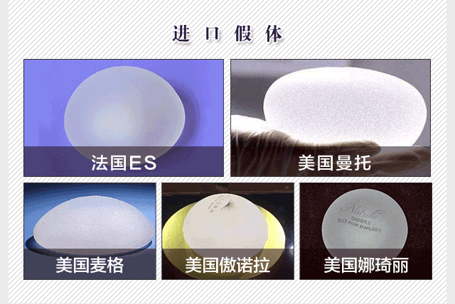 南京隆胸沈正宇和黄名斗的价格怎么样