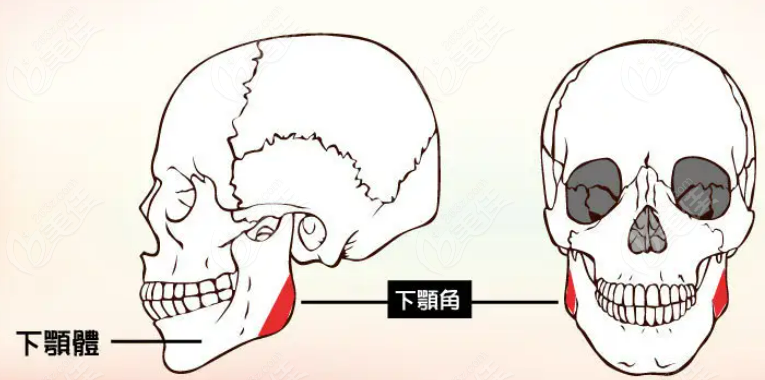 磨骨手术