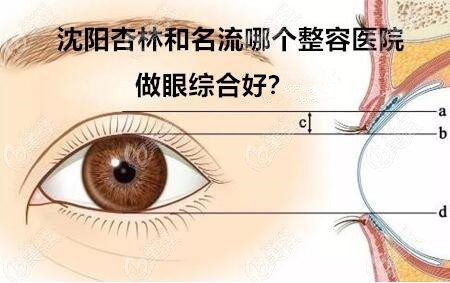 沈阳杏林和名流哪个整容医院做眼综合好