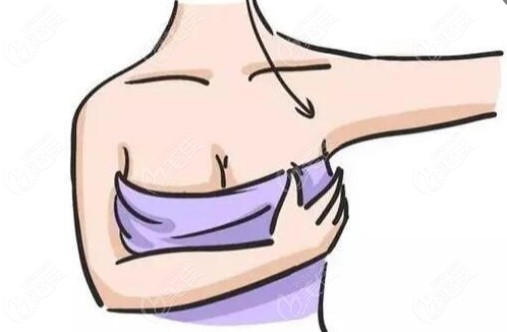 北京李比医生做的内窥镜假体隆胸+双环法乳房上提术后半年恢复图片