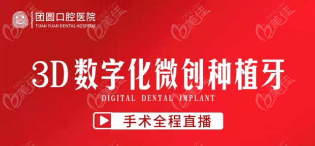 西安团圆口腔医院种植牙直播活动