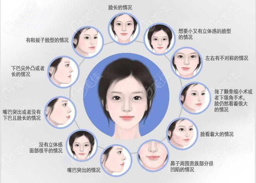 长春正颌手术可以改善的脸型