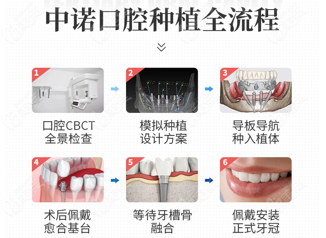 立得用数字化种植牙全流程