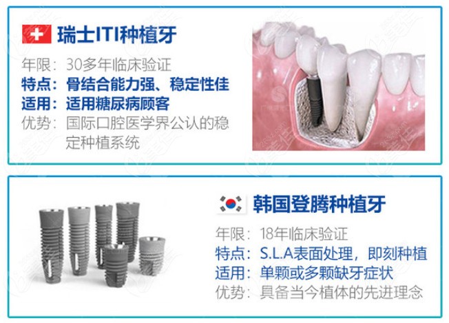 瑞士ITI和韩国登腾种植牙的特点及优点
