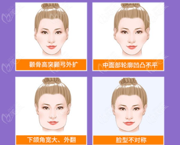 成都友谊医院赵延峰磨骨怎么样