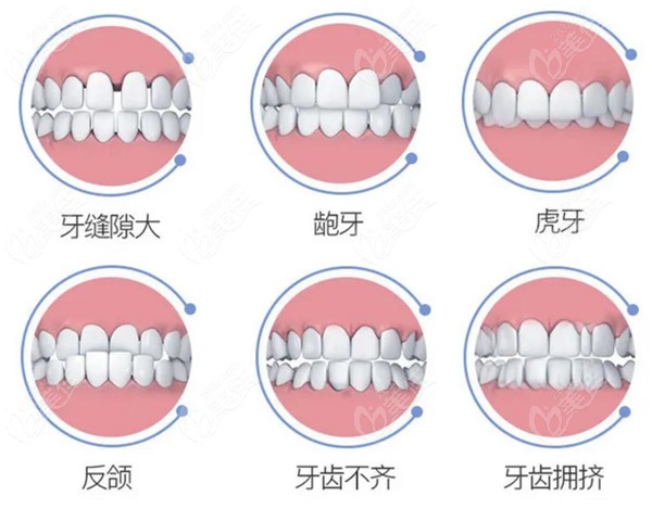 北京西城区牙科牙齿矫正多少钱