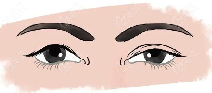 國內(nèi)雙眼皮修復醫(yī)院排名前十強