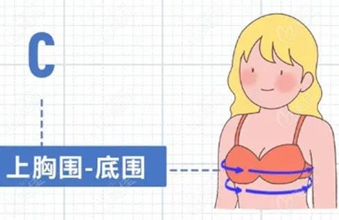 傲诺拉星熠系列假体示例图