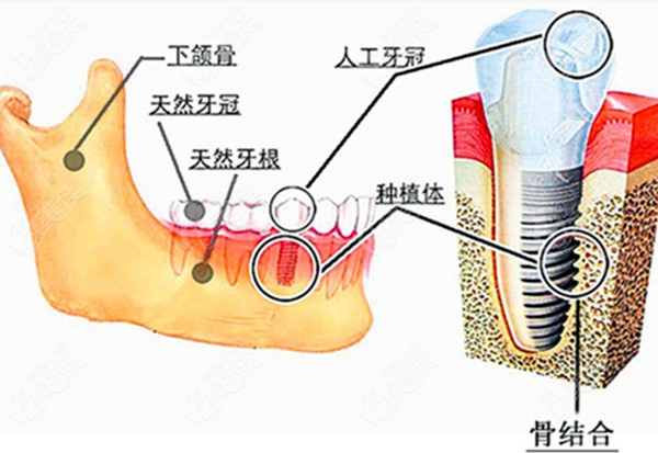 牙槽结构图图片